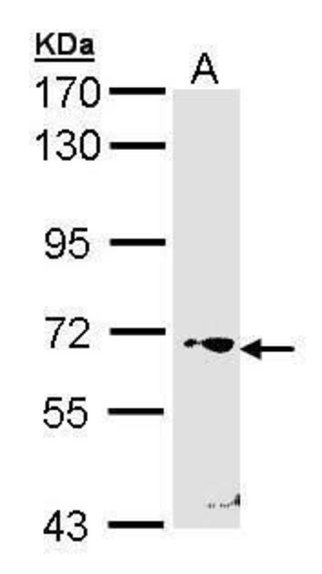 RORC Polyclonal Antibody