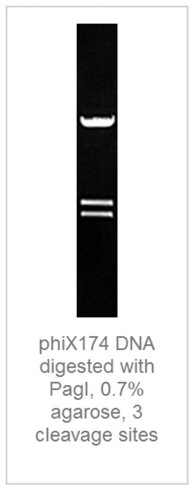 DNA digest