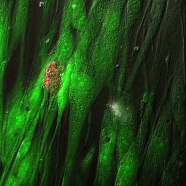 Human Dermal Fibroblast Cells Stained Using the LIVE/DEAD® Cell Imaging Kit