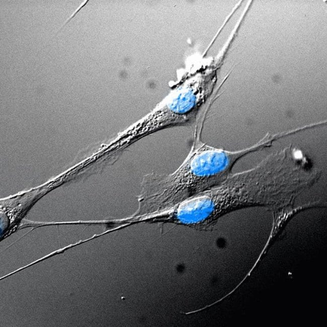 Human Dermal Fibroblasts Stained with NucBlue&trade; Fixed Cell Stain