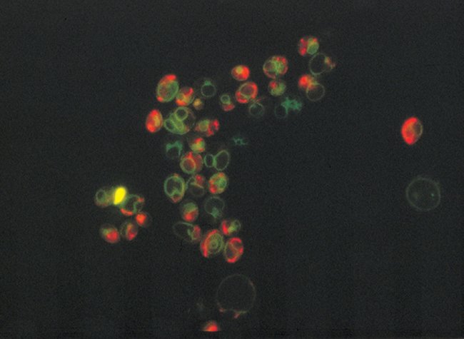 Saccharomyces cerevisiae stained sequentially with rhodamine B hexyl ester and yeast vacuole membrane marker MDY-64.
