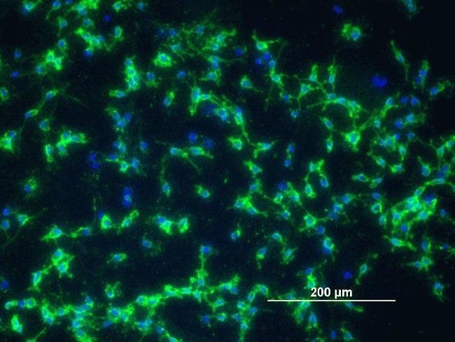 Rat Glial Precursor Cells stained by indirect immunofluorescence for the cell-surface marker A2B5 (green). Nuclei were stained with DAPI (blue). The cells were maintained in the undifferentiated state in StemproNSC + 10 ng/mL PDGF-AA for three days prior to 4% paraformaldehyde fixation and staining. Scale bar = 200 microns.