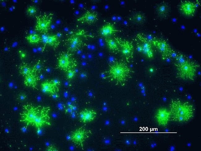 Rat Glial Precursor Cells differentiating to oligodendrocytes. The cells were differentiated in DMEM/F12 + N2 + 2% fetal bovine serum for three days prior to 4% paraformaldehyde fixation and staining. The cell-surface marker GalC  was detected by indirect immunofluorescence (green). Nuclei were stained with DAPI (blue).  Scale bar = 200 microns.