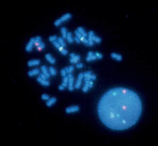 Centromeres of chromosome 1, chromosome 15 and chromosome 17.