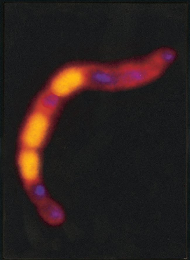 Bifidobacterium sp. bacteria stained with the ViaGram™ Red+ Bacterial Gram Stain and Viability Kit.