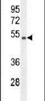 https://www.dev3.thermofisher.com/content/dam/LifeTech/Images/Brands/search/default-brand.jpg
