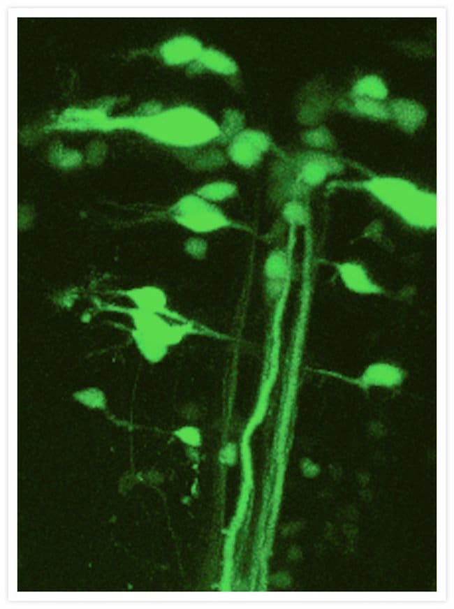Zebrafish reticulospinal neuron. Calcium Green™-1 10,000 MW dextran.