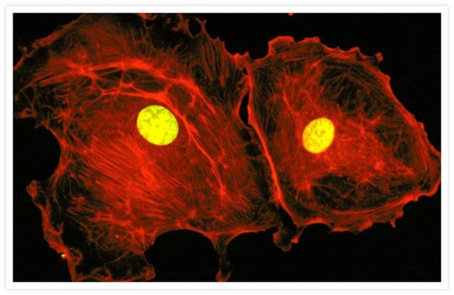 Bovine pulmonary artery endothelial cells. SYTOX&#174; Green nucleic acid stain and BODIPY&#174; TR-X phallacidin.