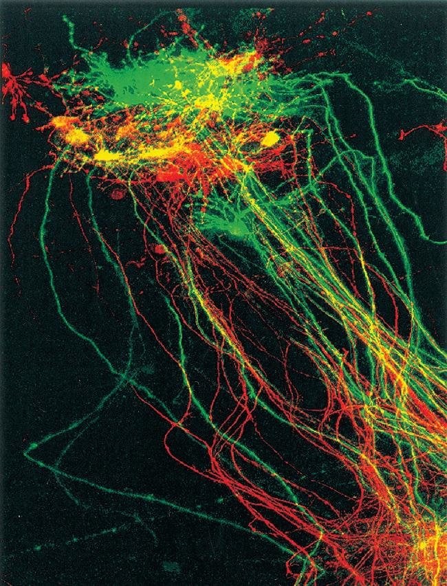 Neurons in ventrobasal nucleus of newborn mouse thalamus. DiI, DiD.