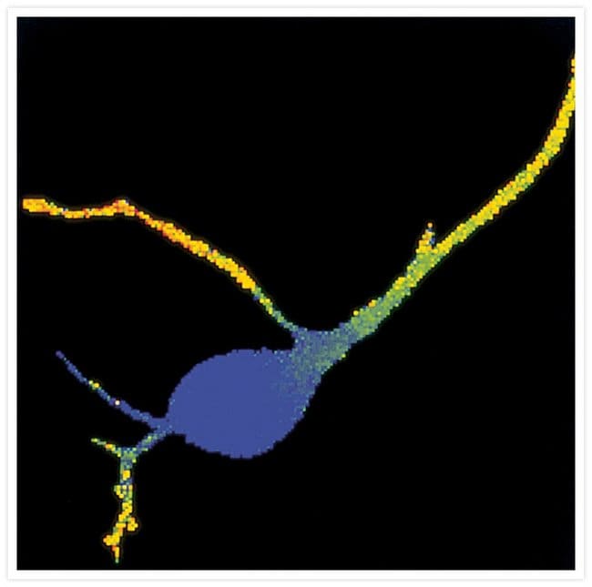 False-color image of free Ca2+ concentration in a Purkinje neuron from embryonic mouse cerebellum.