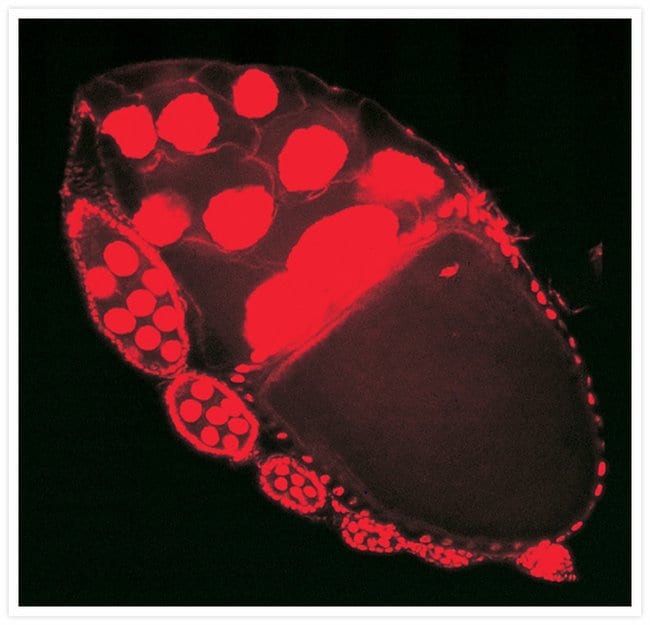 Drosophila ovarian egg chamber.