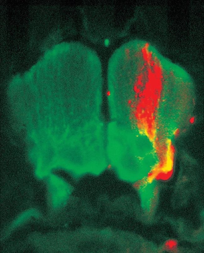 Brain of a zebrafish embryo. CellTracker CM-DiI.