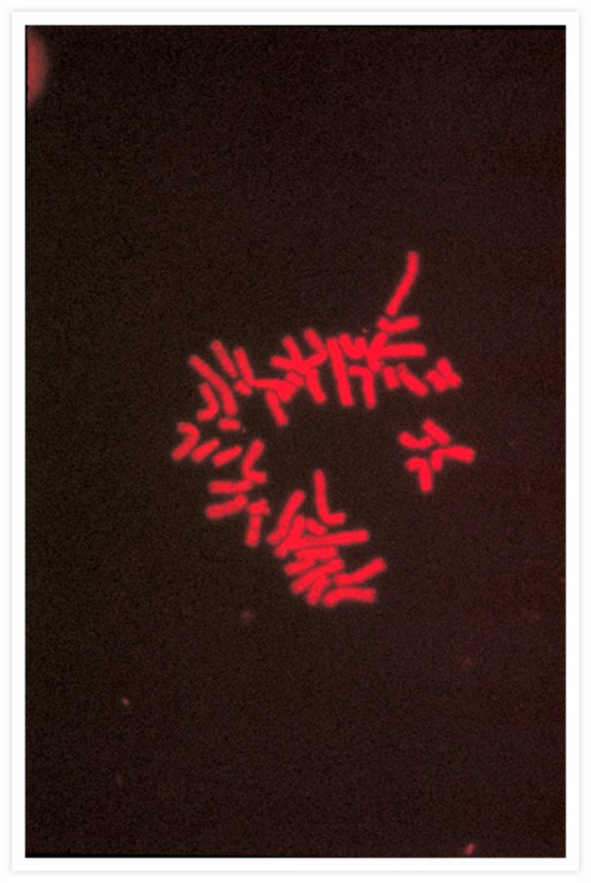 Human metaphase chromosomes. Propidium iodide.
