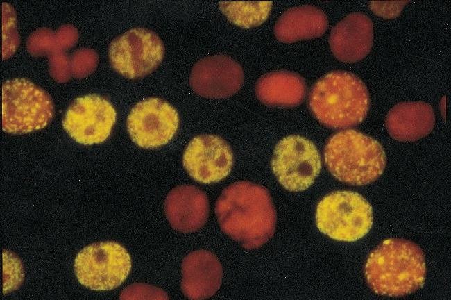 Exponentially growing promyelocytic leukemia (HL60) cells. Hoechst 33258 and ChromaTide BODIPY FL-14-dUTP.