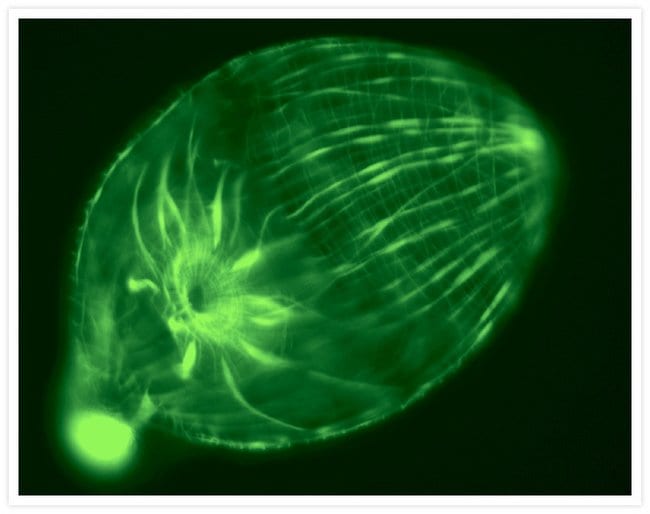 Actin filaments of the turbellarian flatworm Archimonotresis sp.