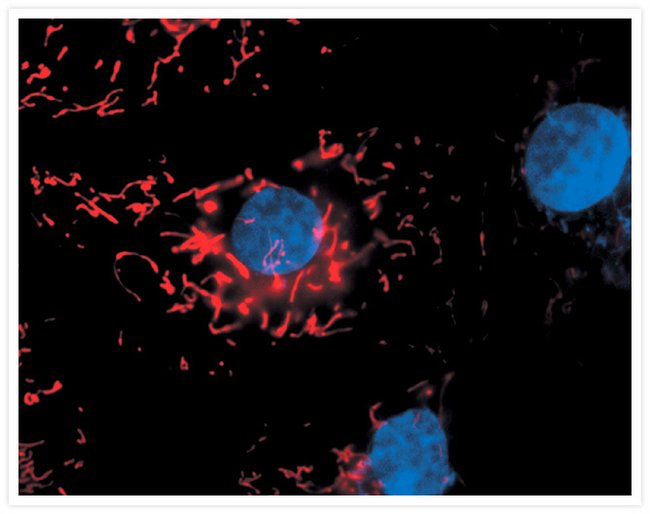 Viable bovine pulmonary artery endothelial cells incubated simultaneously with MitoFluor™ Red 594 and Hoechst 33342.