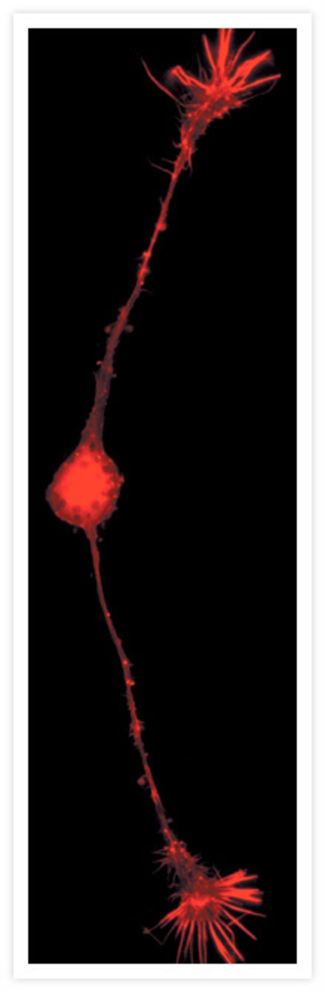 Rat embryonic sensory neuron.  Rhodamine phalloidin.