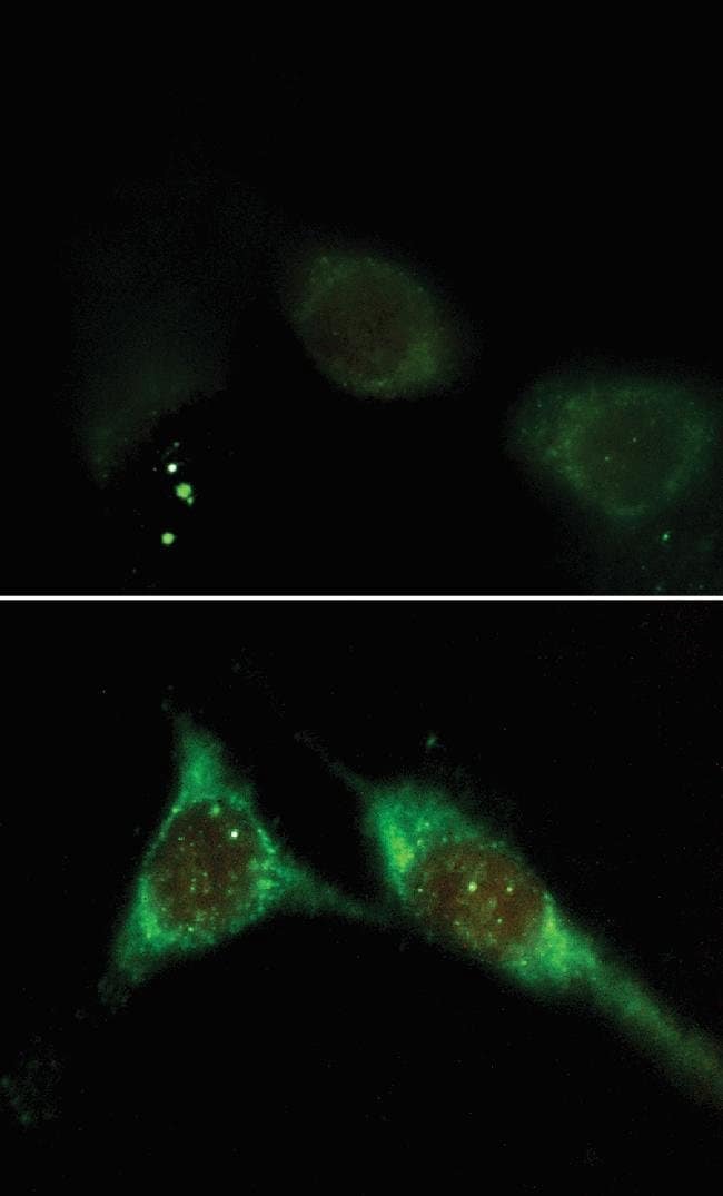 3T3-L1 cells. Anti–phosphatidylinositol 3,4,5-triphosphate antibody (mouse IgM monoclonal RC6F8); biotinylated goat anti–mouse IgM antibody; Alexa Fluor 488 streptavidin.