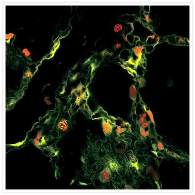 Rat lung cells. LIVE/DEAD® Viability/Cytotoxicity Kit, ethidium homodimer-1 and calcein AM.