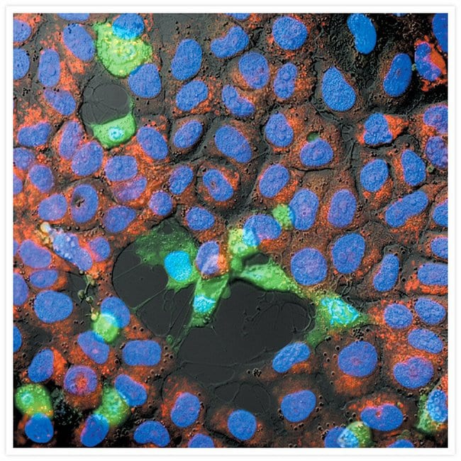 Detection of apoptosis in SK-N-MC neuroblastoma cells.
