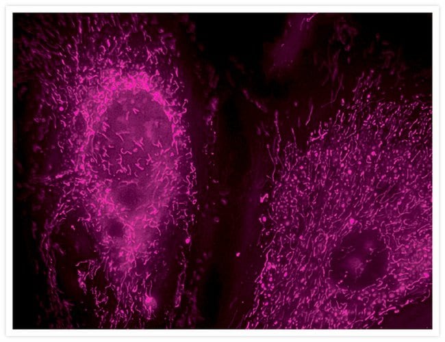 Mitochondria of live bovine pulmonary artery endothelial cells stained with the MitoTracker® Deep Red FM.