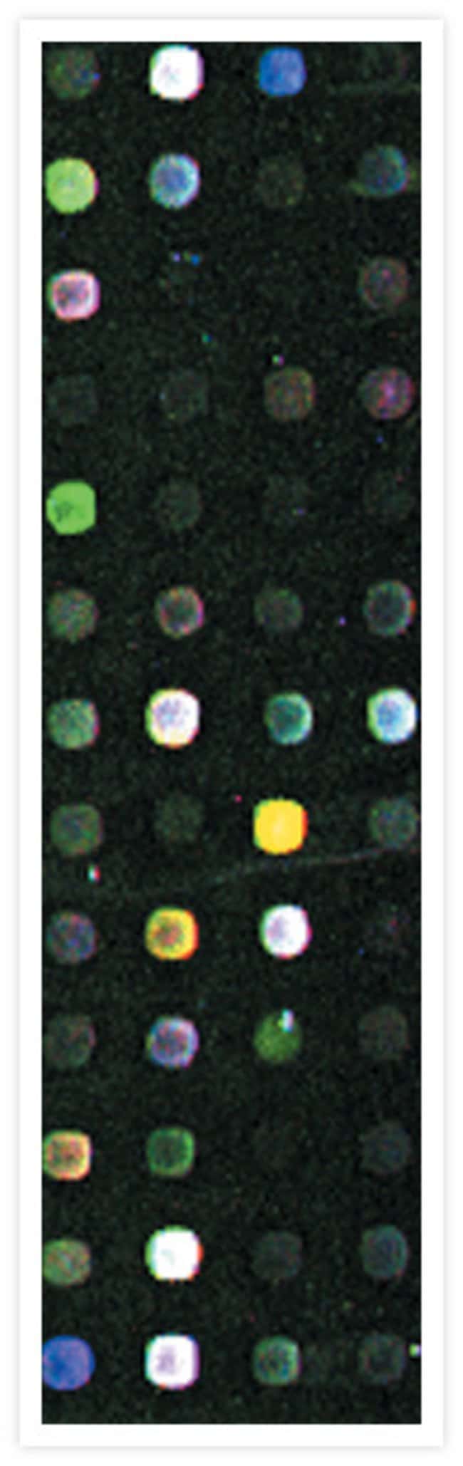 A cDNA microarray hybridized with three different cDNA samples labeled using our ARES™ DNA Labeling Kits.