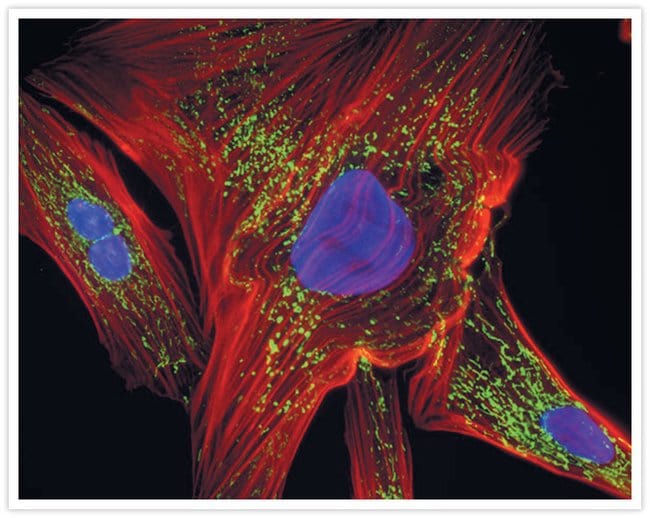 UV-irradiated muntjac skin fibroblasts showing mitochondrial damage.