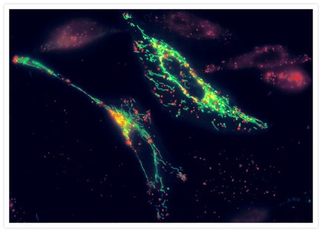 Live HeLa cells stained with the reagents in the Image-iT® LIVE Lysosomal and Nuclear Labeling Kit.