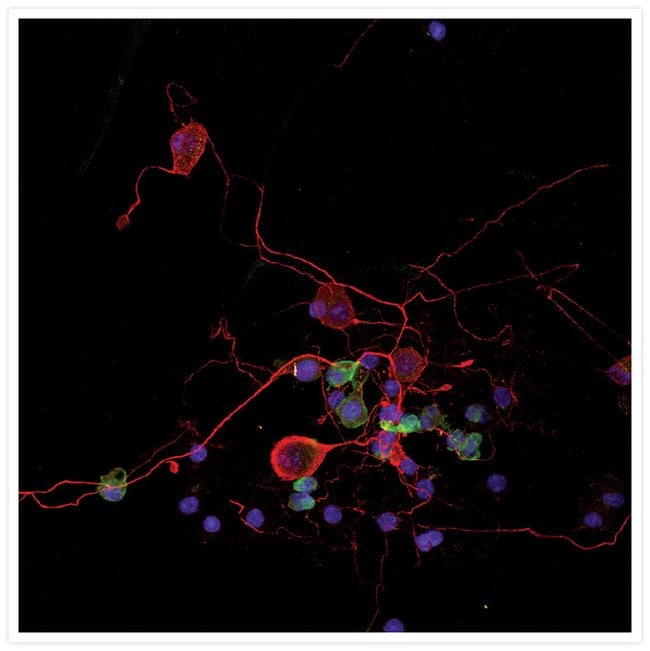 Fluorescence immunostaining of a fixed co-culture of murine neurons and dendritic cells.