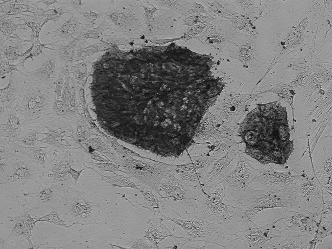 Live human iPSC cells were stained using Alkaline Phosphate (A14353) stain and imaged on the FLoid® Cell Imaging Station (Cat.no. 4471136).