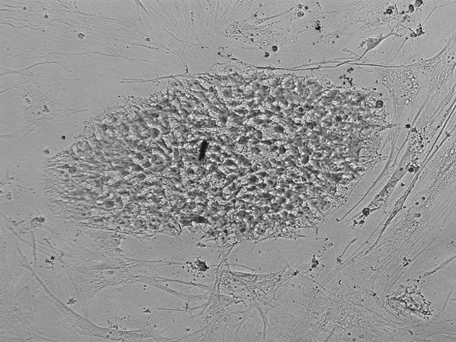 Human iPSC cells were washed with Live Cell Imaging Solution (A14291DJ) and imaged on the FLoid® Cell Imaging Station (Cat.no. 4471136).