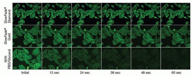 Enhanced resistance to photobleaching afforded by SlowFade® antifade reagents