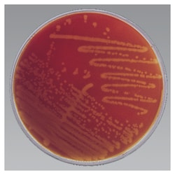 HBT Bilayer Medium (Human Blood-Polysorbate 80)