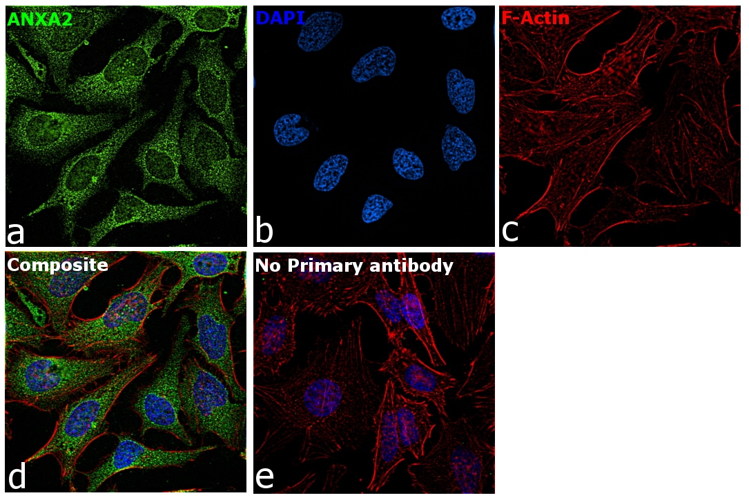 Annexin A2 Antibody (03-4400)