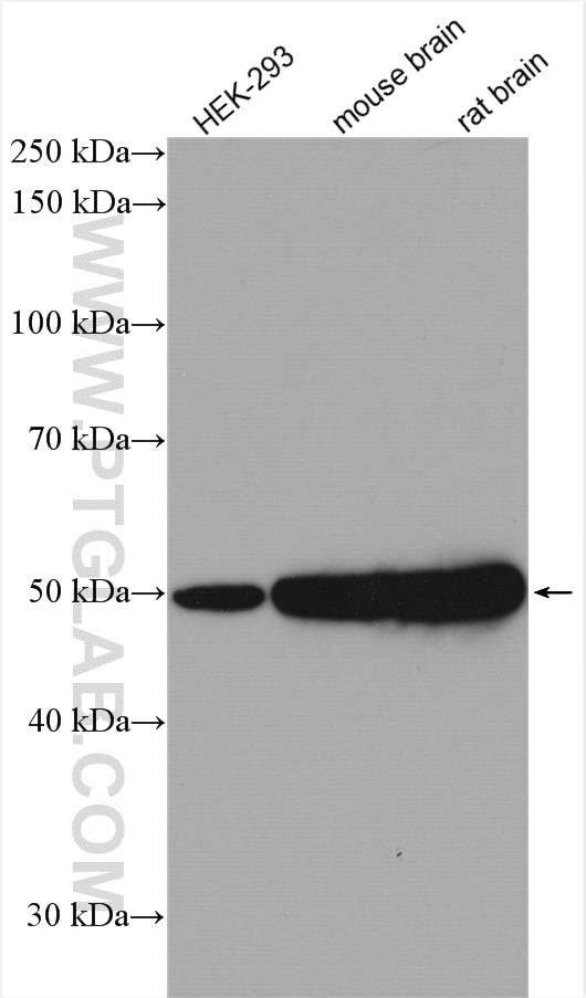 beta Tubulin Antibody (10094-1-AP)