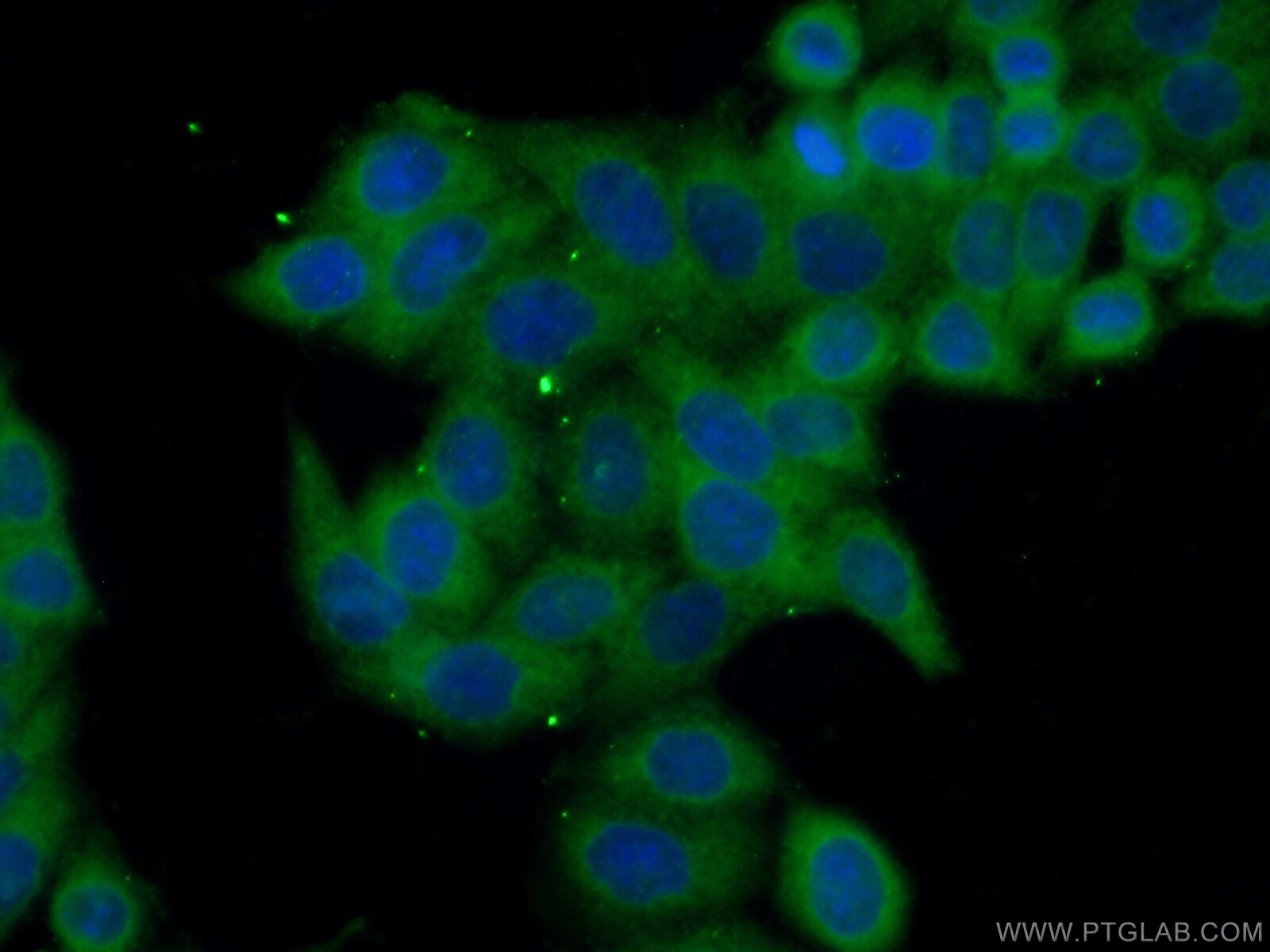 TGFBI / BIGH3 Antibody in Immunocytochemistry (ICC/IF)