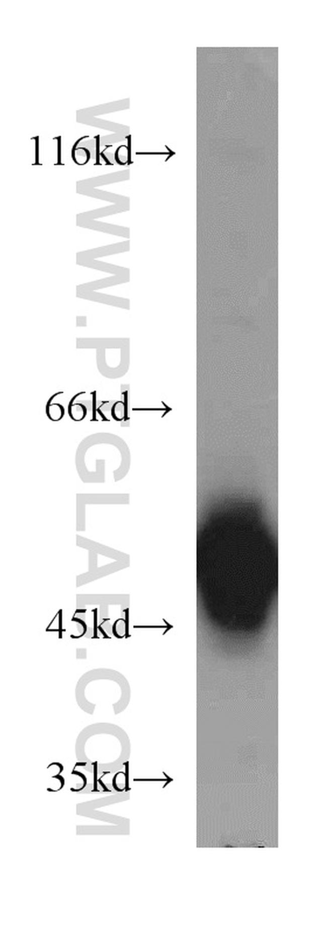 EIF2S2 Antibody in Western Blot (WB)