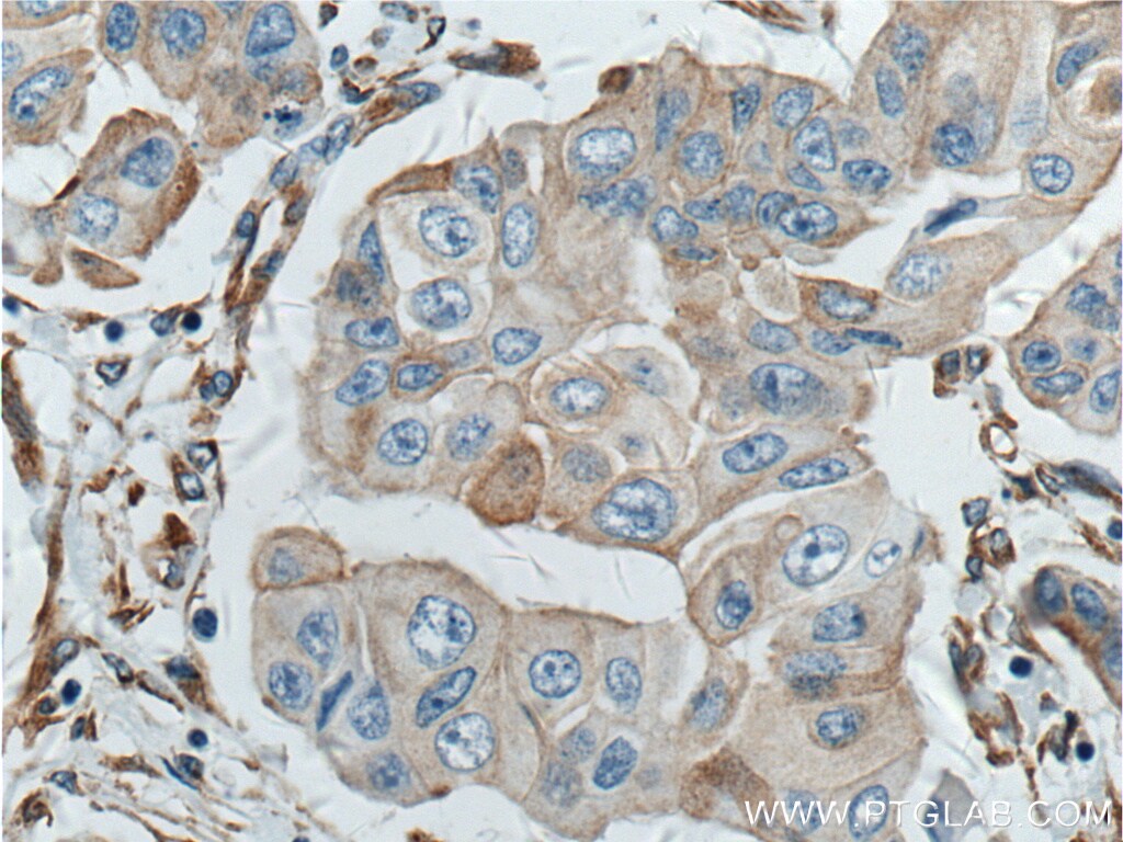 Stanniocalcin 2 Antibody in Immunohistochemistry (Paraffin) (IHC (P))