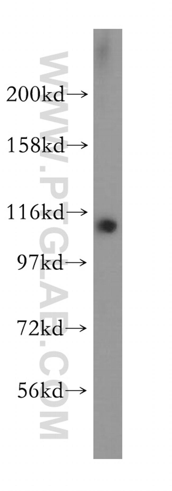 MOV10 Antibody in Western Blot (WB)