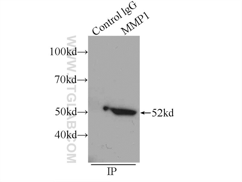 MMP1 Antibody in Immunoprecipitation (IP)