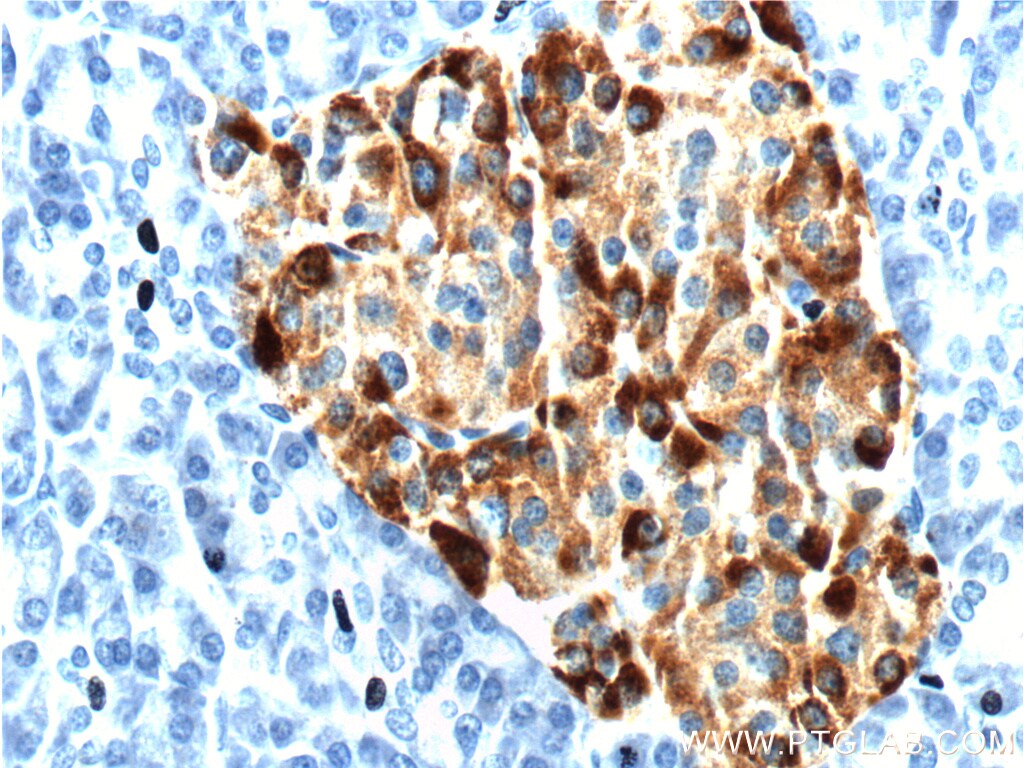 Chromogranin A Antibody (105291AP) Chromogranin A Antibody (105291AP)