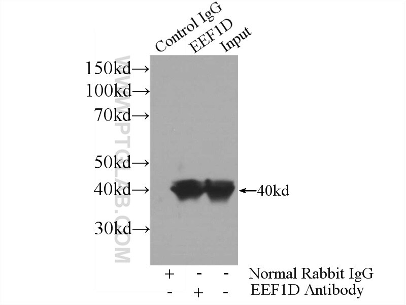 EEF1D Antibody in Immunoprecipitation (IP)