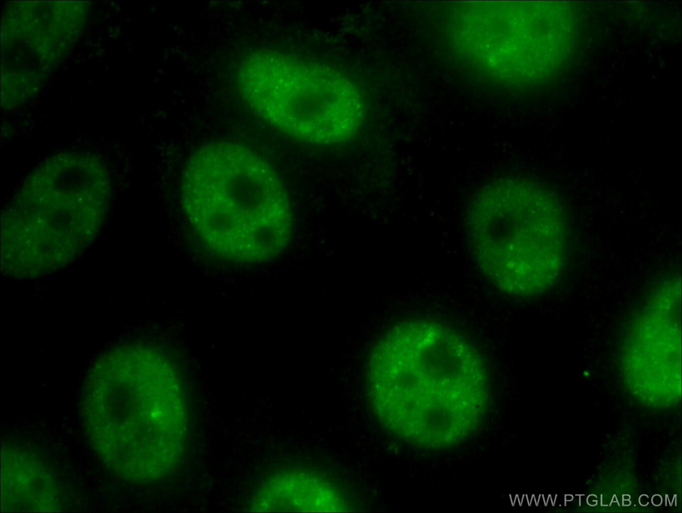TDP-43 Antibody in Immunocytochemistry (ICC/IF)
