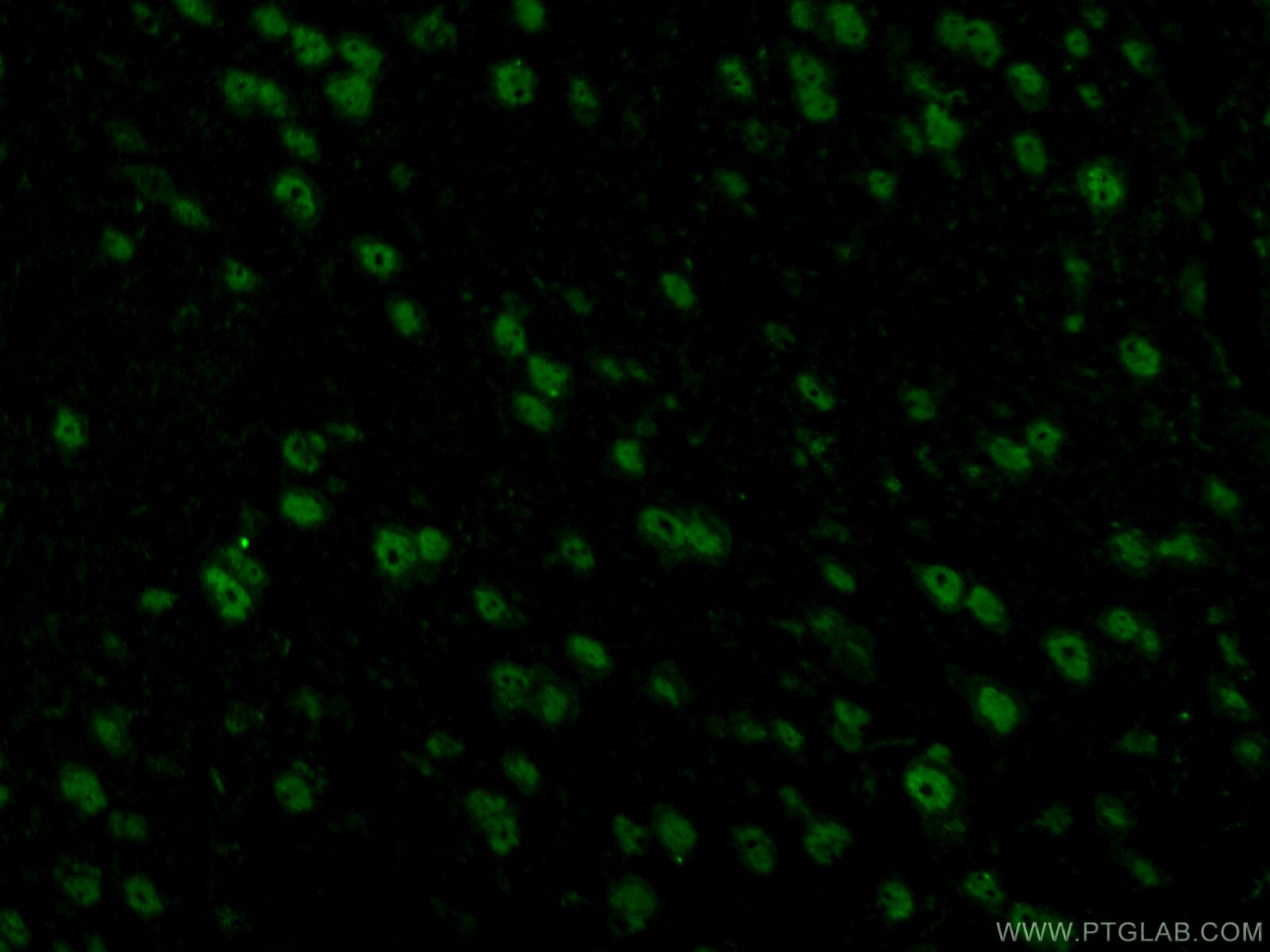 TDP-43 Antibody in Immunohistochemistry (PFA fixed) (IHC (PFA))