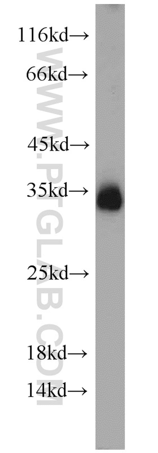 Syntaxin 6 Antibody in Western Blot (WB)