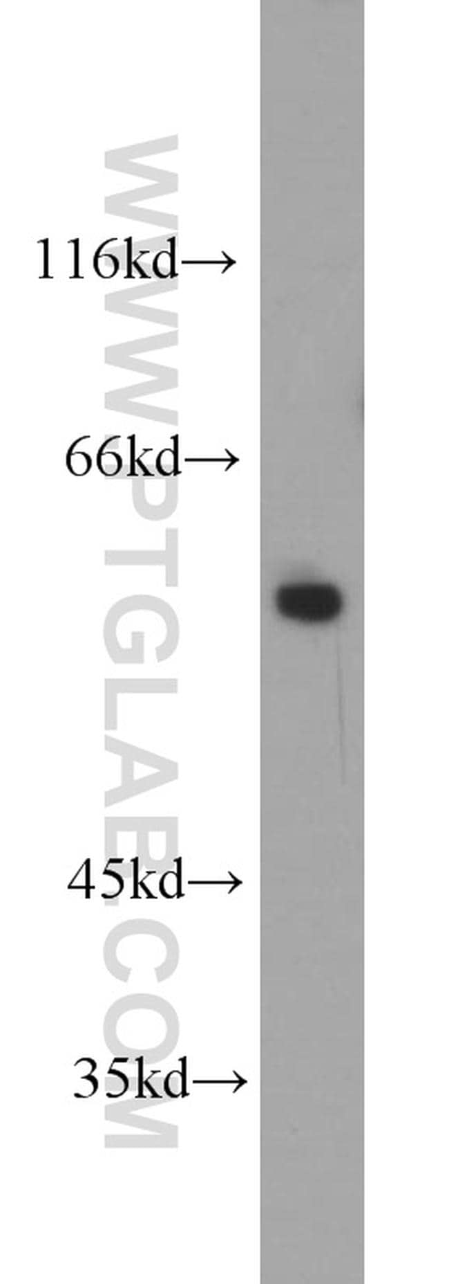 FBXO5 Antibody in Western Blot (WB)