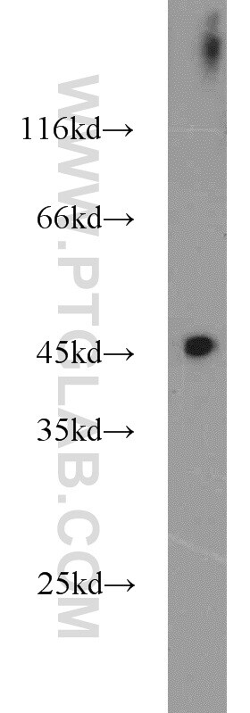 FBXO5 Antibody in Western Blot (WB)