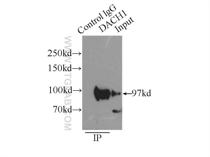 DACH1 Antibody in Immunoprecipitation (IP)
