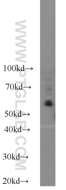 KLRG1 Antibody in Western Blot (WB)