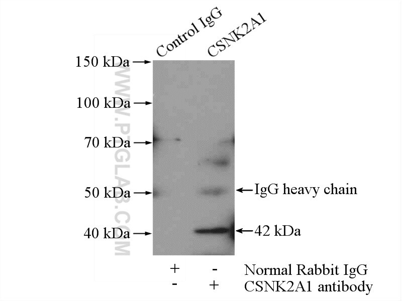 CSNK2A1 Antibody in Immunoprecipitation (IP)